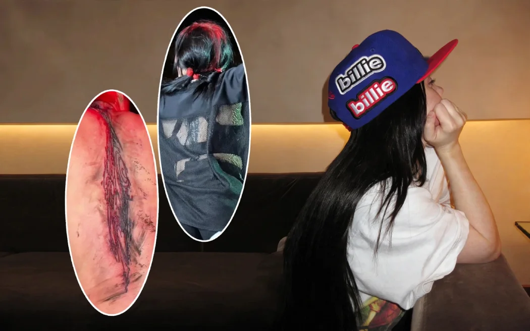 Billie Eilish abstract spine tattoo close-up with side profile wearing Billie cap