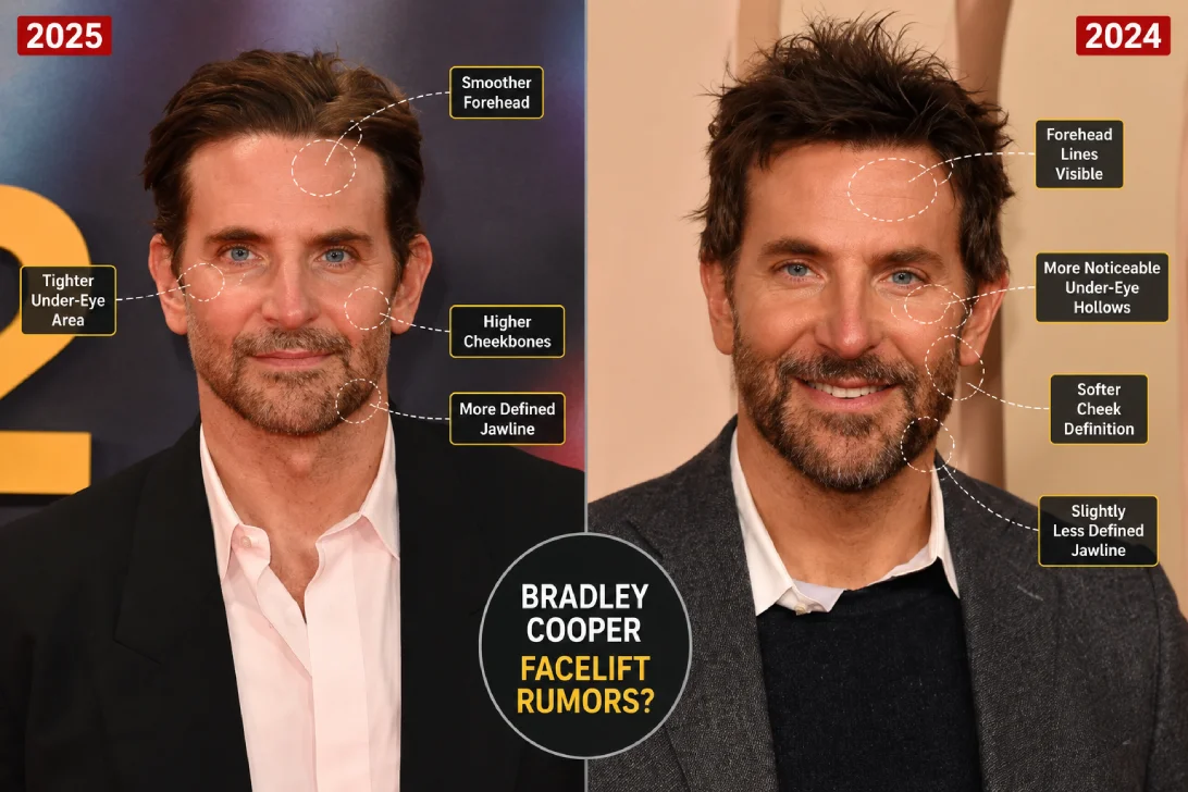 Side-by-side comparison of Bradley Cooper's 2024 and 2025 appearances highlighting facelift rumors.